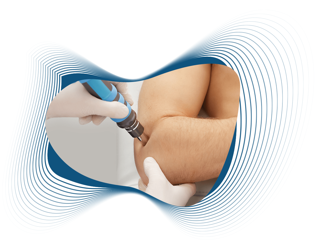 Shockwave Therapy